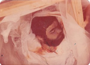 پیکر شهید علی هاها و گلوی بریده شهید